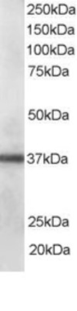 PDLIM1 Antibody, Novus Biologicals 0.1mg; Unlabeled:Antibodies, Polyclonal